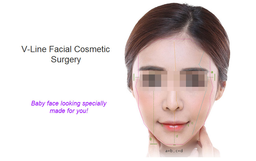 V-line facial contouring